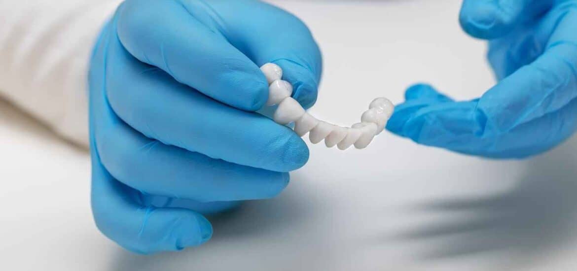Dentist Holds Artificial Teeth by Wearing Hand Gloves | Smile Virtual