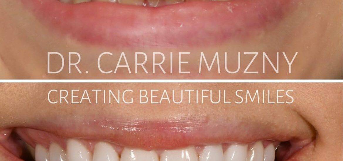 Online Dental Marketing By Smile Virtual