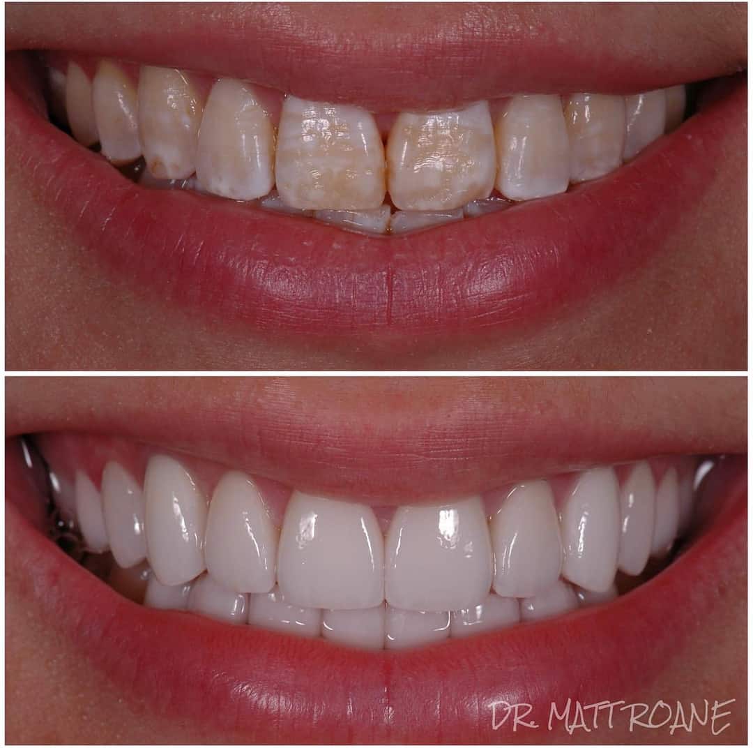 Smile Transformation by Smile virtual
