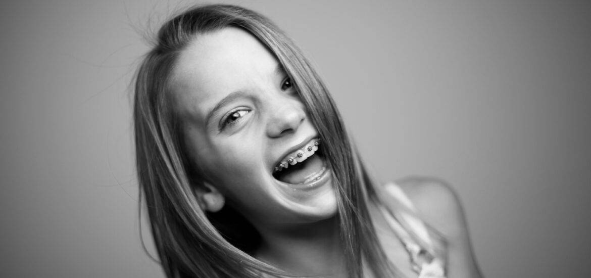 Smiling Girl with Teeth Braces on Black and White Photo | Smile Virtual