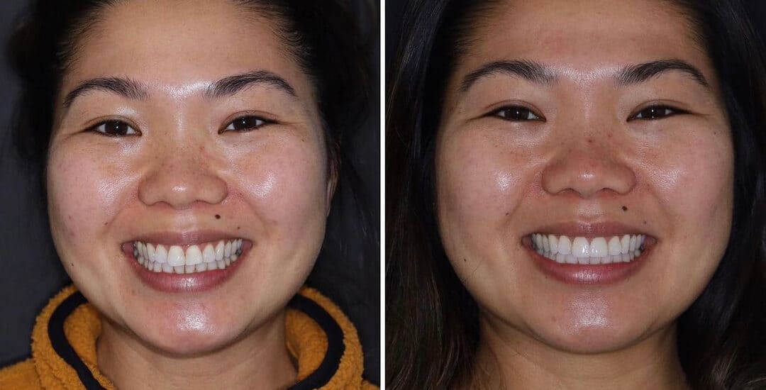 Cosmetic Dentistry By Smile Virtual